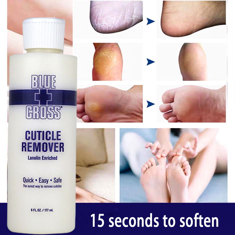 Foot Mask Peeling - ผลิตภัณฑ์ขัดผิวเท้า กำจัดหนังกำพร้า ขจัดเซลล์ผิวที่ตายแล้ว น้ำยาขัดส้นเท้า ผลิตภัณฑ์บำรุงเล็บเท้า กำจัดหนังด้าน