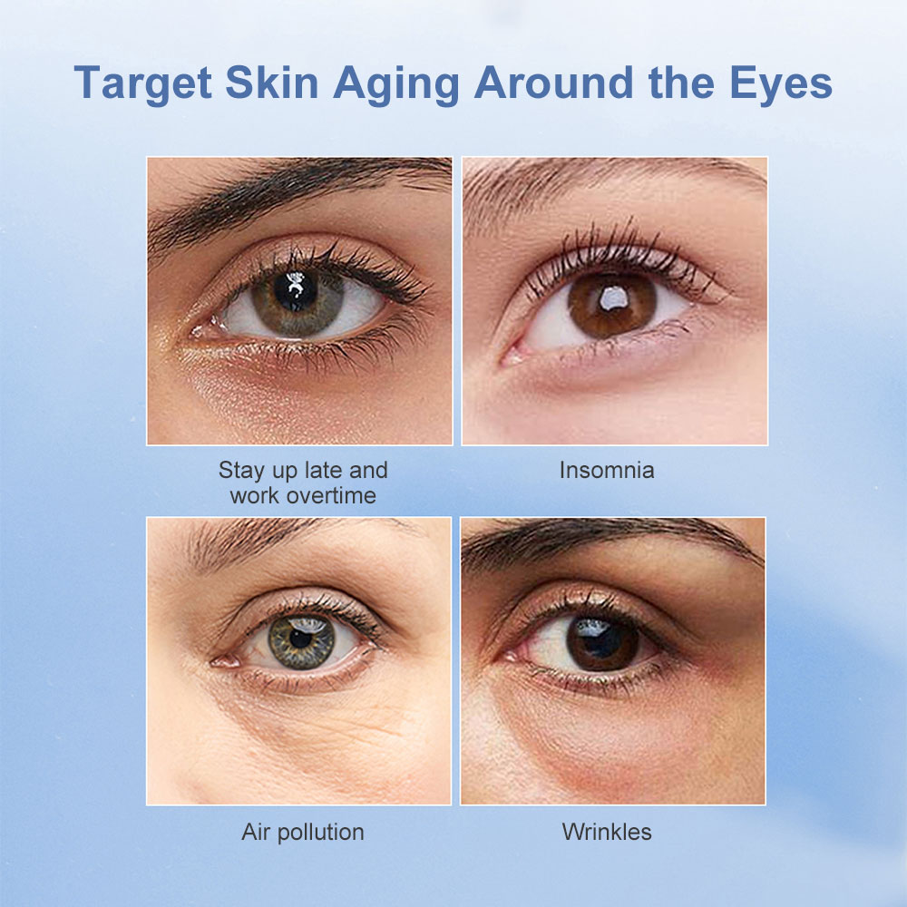 แผ่นมาส์กใต้ตาแบบไมโครนีดเดิล  - Microneedle Patch Eye บทวิจารณ์และราคา