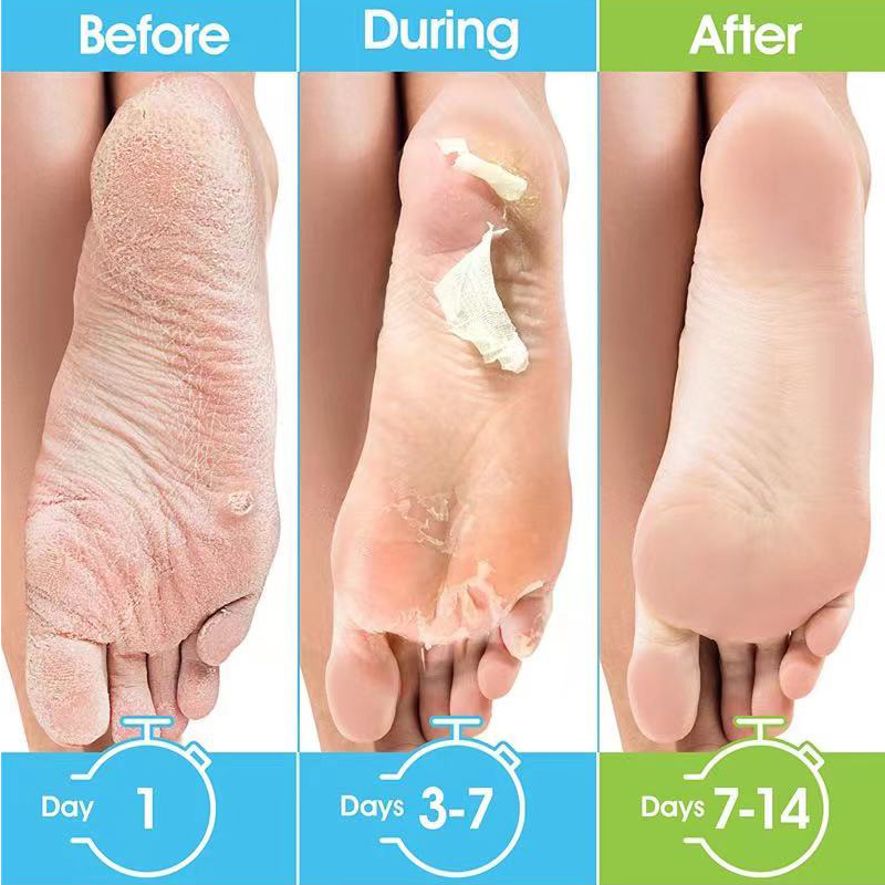 1 แพ็ค = 1 คู่ มาส์กเท้าสูตรน้ - Foot Mask Peeling บทวิจารณ์และราคา