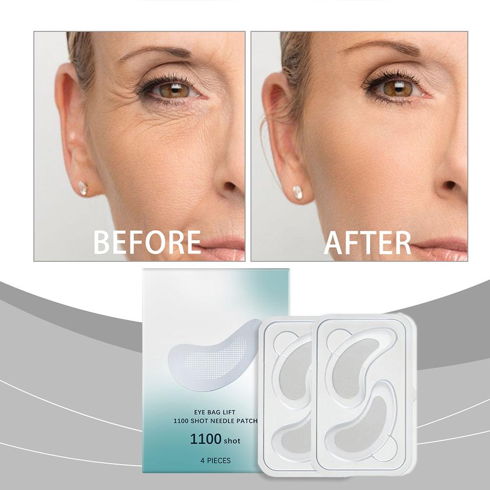 Hyaluronic Acid Microneedle Ey - Microneedle Patch Eye บทวิจารณ์และราคา
