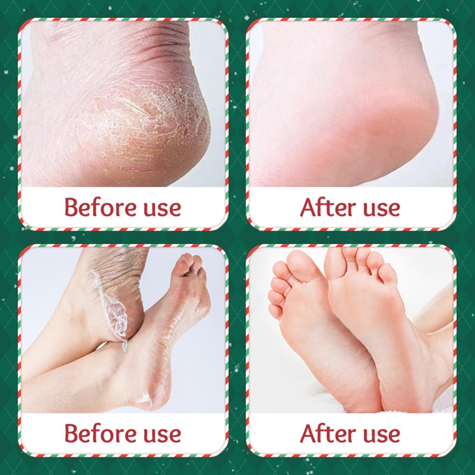 3 ชิ้นมาส์กลอกผิวเท้าของขวัญคร - Foot Mask Peeling บทวิจารณ์และราคา