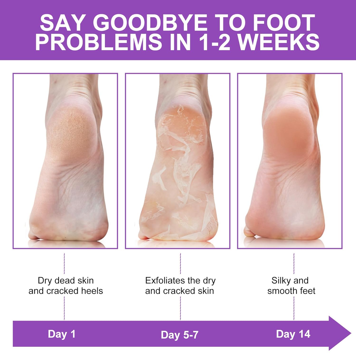 ถุงเท้าขัดผิว ขจัดหนังด้าน ขจั - Foot Mask Peeling บทวิจารณ์และราคา