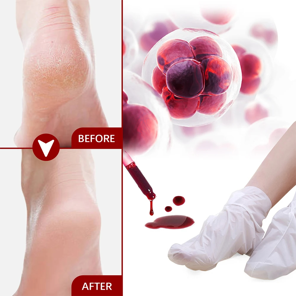 5/2/1 คู่หน้ากากเท้าผลไม้กรด E - Foot Mask Peeling บทวิจารณ์และราคา